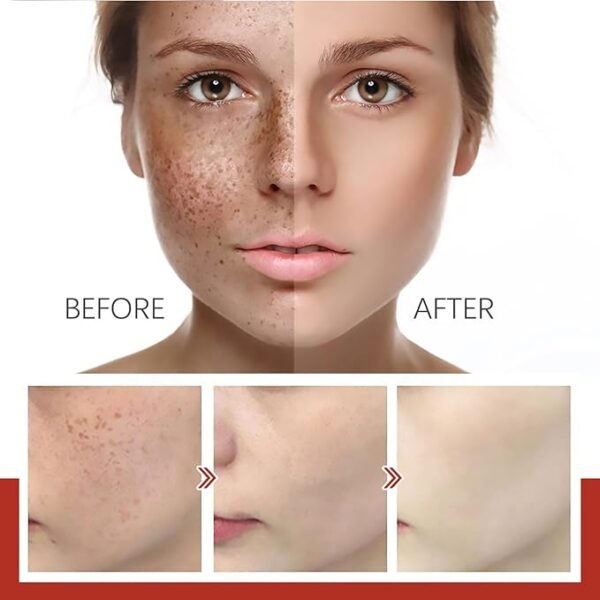 Eelhoe - Pigment Correcting Cream (Original) - Image 3