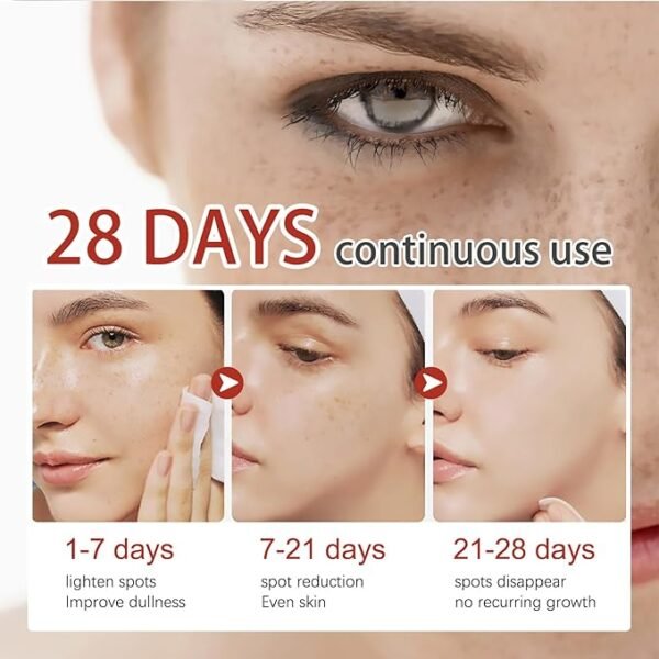 Eelhoe - Pigment Correcting Cream (Original) - Image 5