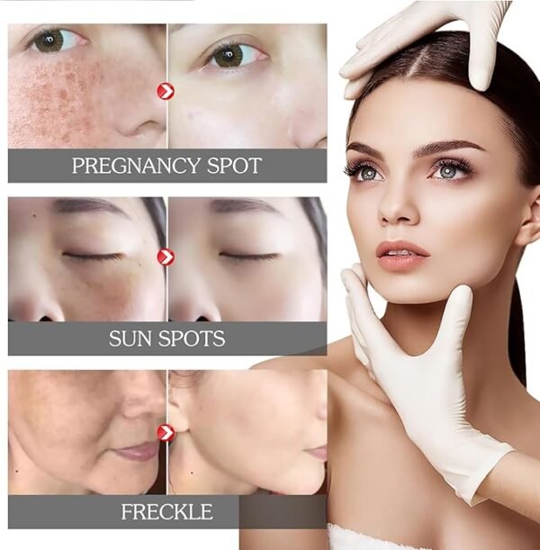 Eelhoe - Pigment Correcting Cream (Original) - Image 4