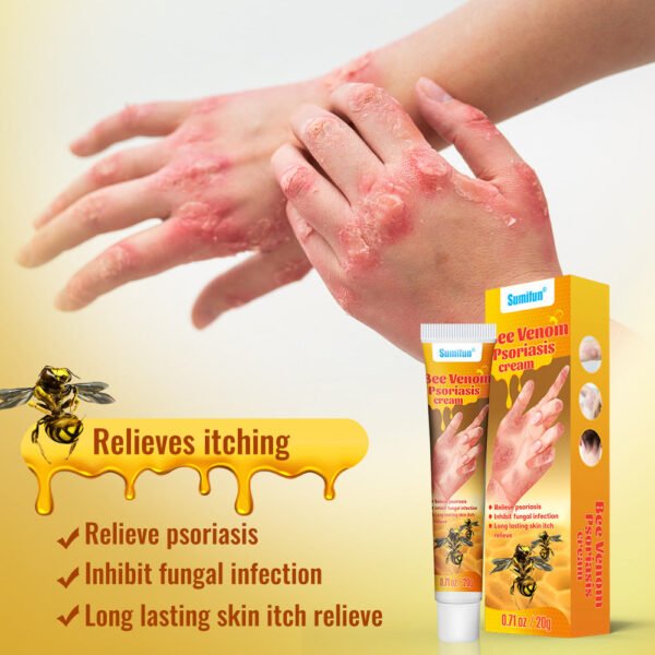 Summifun - Bee Venom Psoriasis Cream (Original) - Image 3